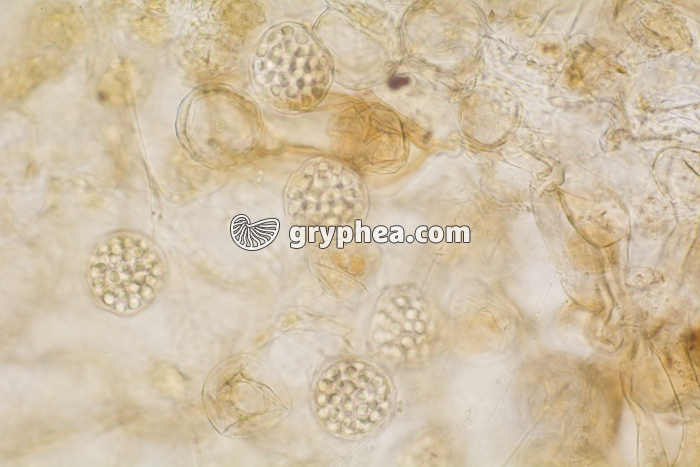 Fougère - Anthéridies remplies d'anthérozoïdes  sur un prothalle de fougère x100 - gryphea.org